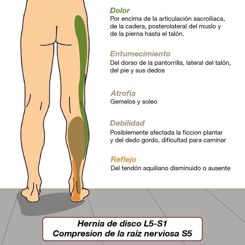 adicional1
