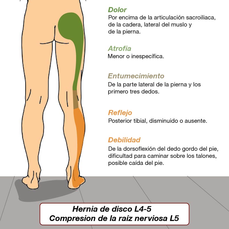 adicional3